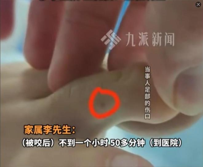 三亚女游客被中毒身亡后续！医学博主提出质疑不是蛇咬而是毒虫(图14)