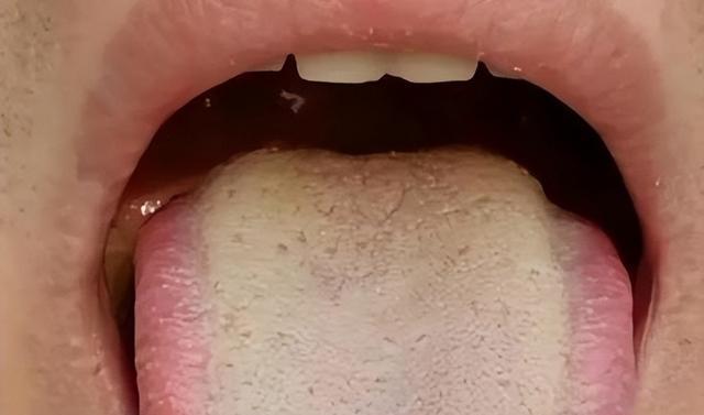 经常咳痰的人6样食物要避开伤肺又加重吃多了痰更难消(图8)